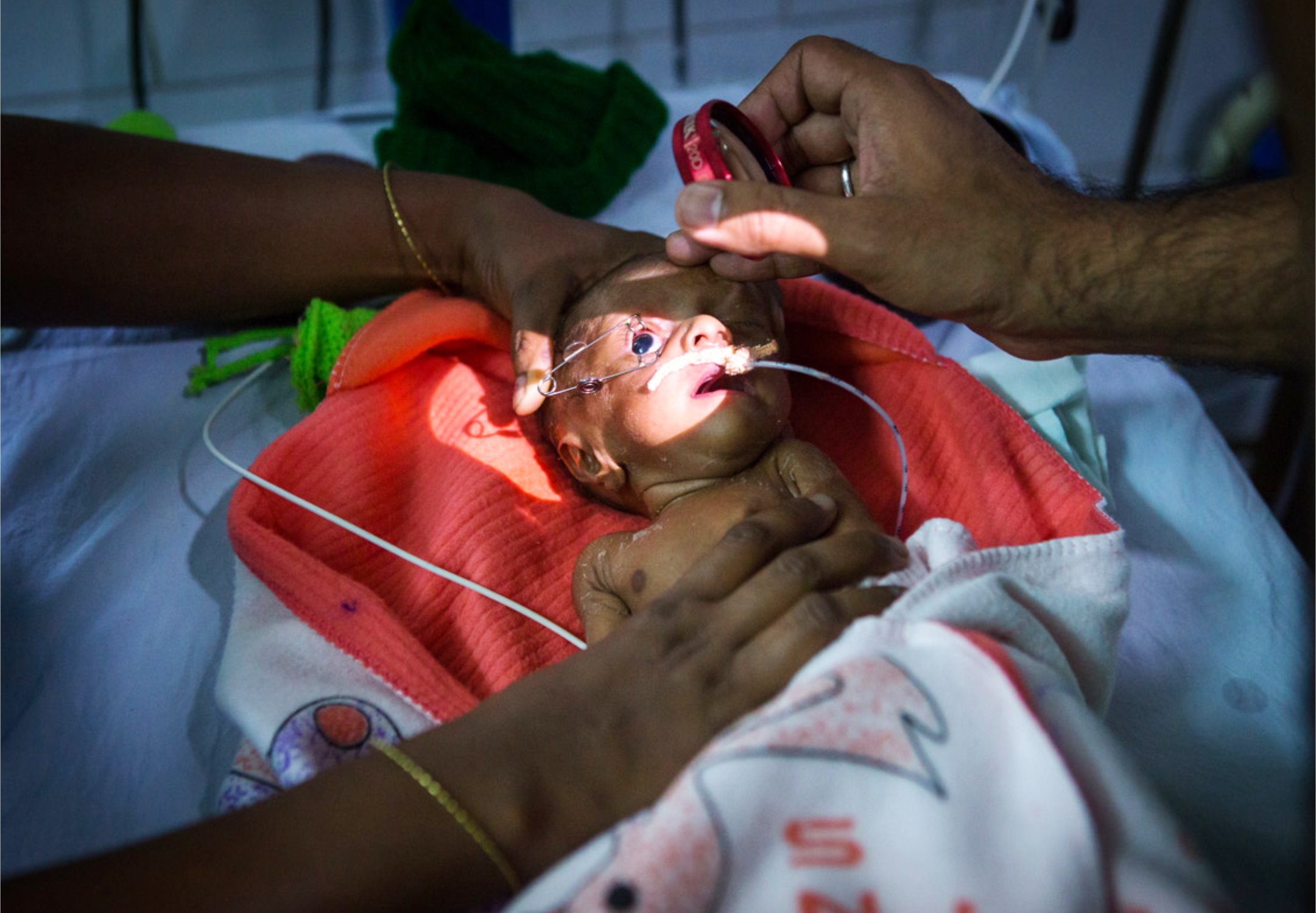 ROP screening and treatment 1080'750